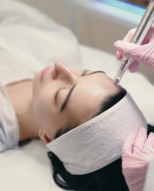 Microneedling